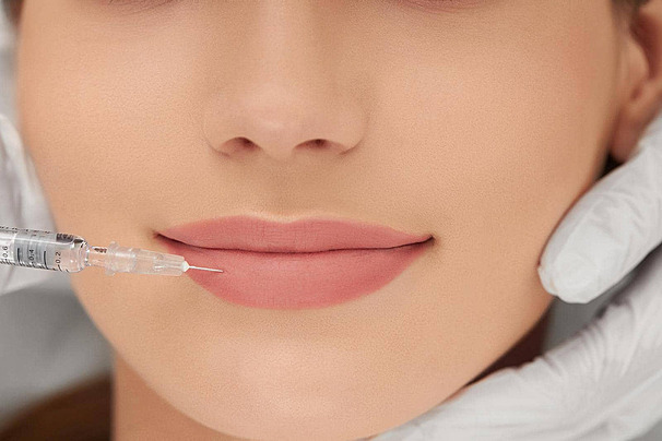 Dermal Filler Injection